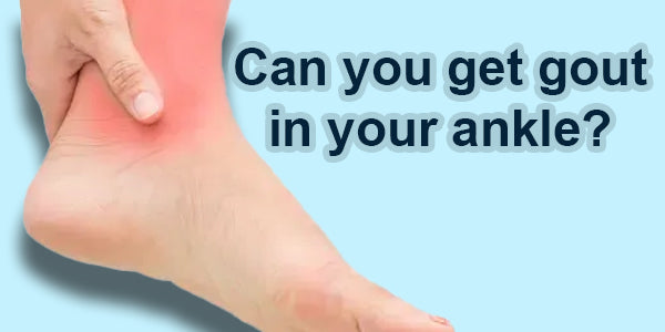 Can you get gout in your ankle? What you need to know
