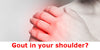Can you get gout in your shoulder?